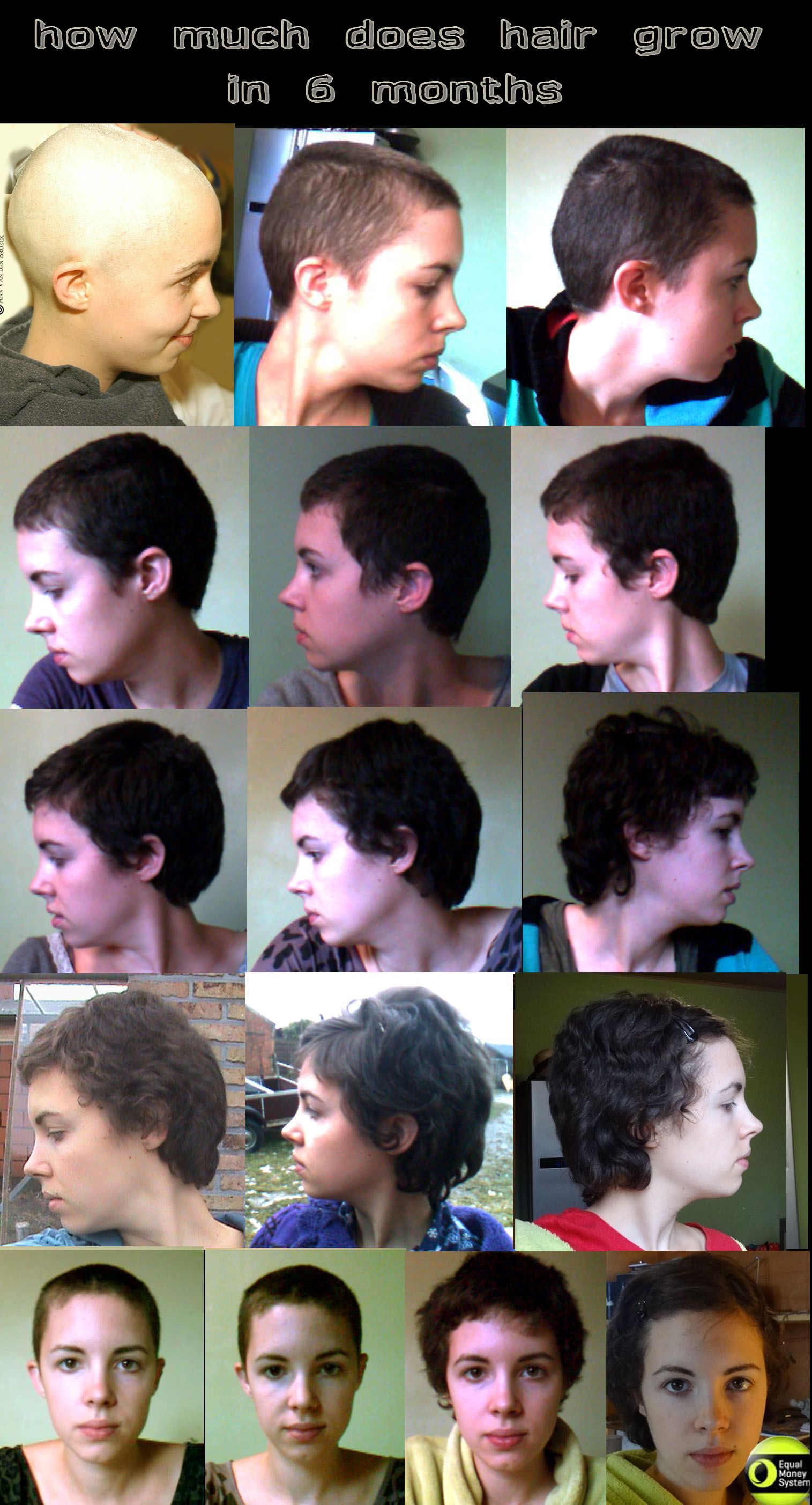 picture Shaved Head Woman Growth