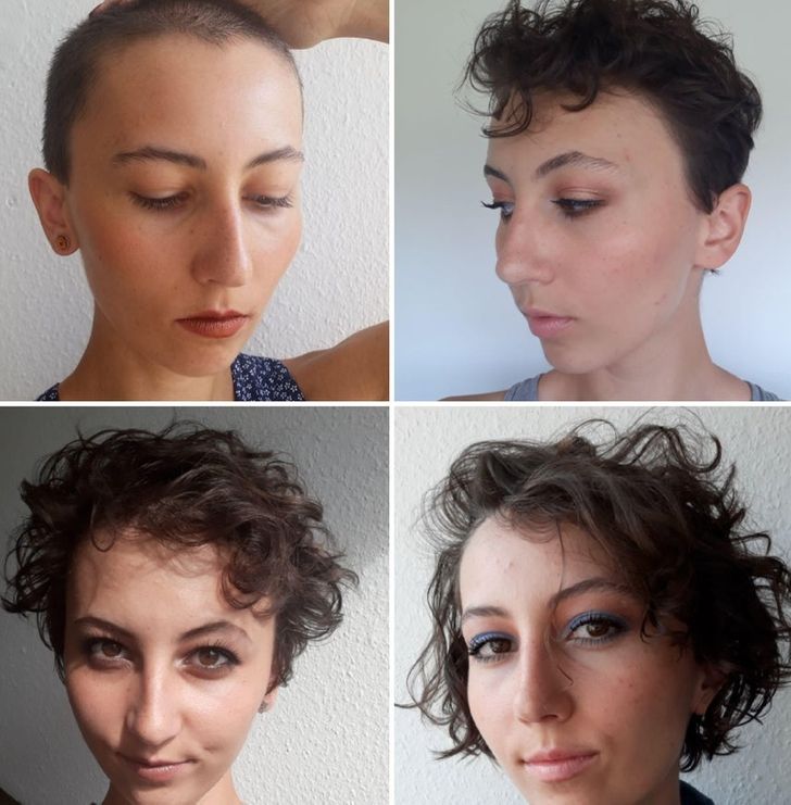 pic Shaved Head Woman Growth